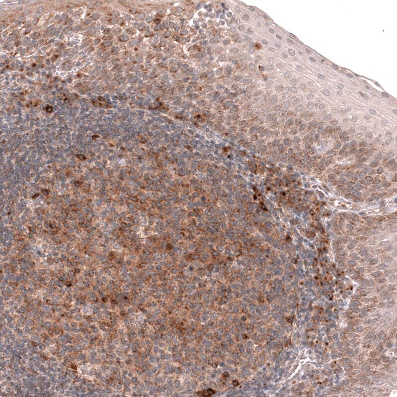 Staining of human tonsil shows moderate to strong cytoplasmic positivity in germinal center cells.