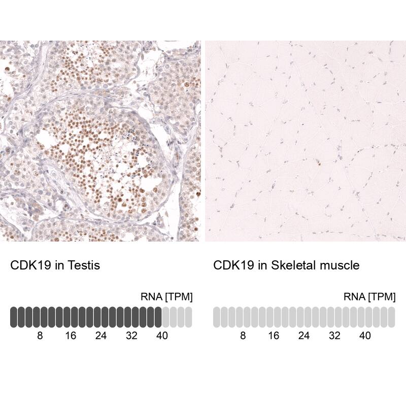 Analysis in human testis and skeletal muscle tissues using NBP3-44339 antibody. Corresponding CDC2L6 RNA-seq data are presented for the same tissues.