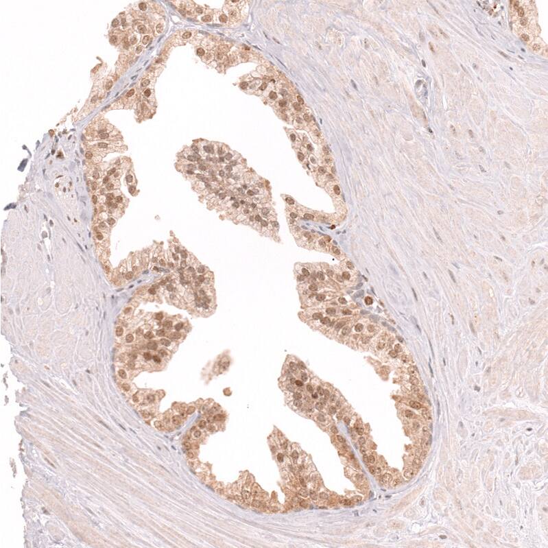 Staining of human prostate shows moderate nuclear positivity in glandular cells.