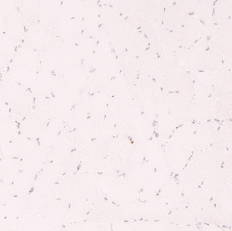 Staining of human skeletal muscle shows no positivity in myocytes as expected.