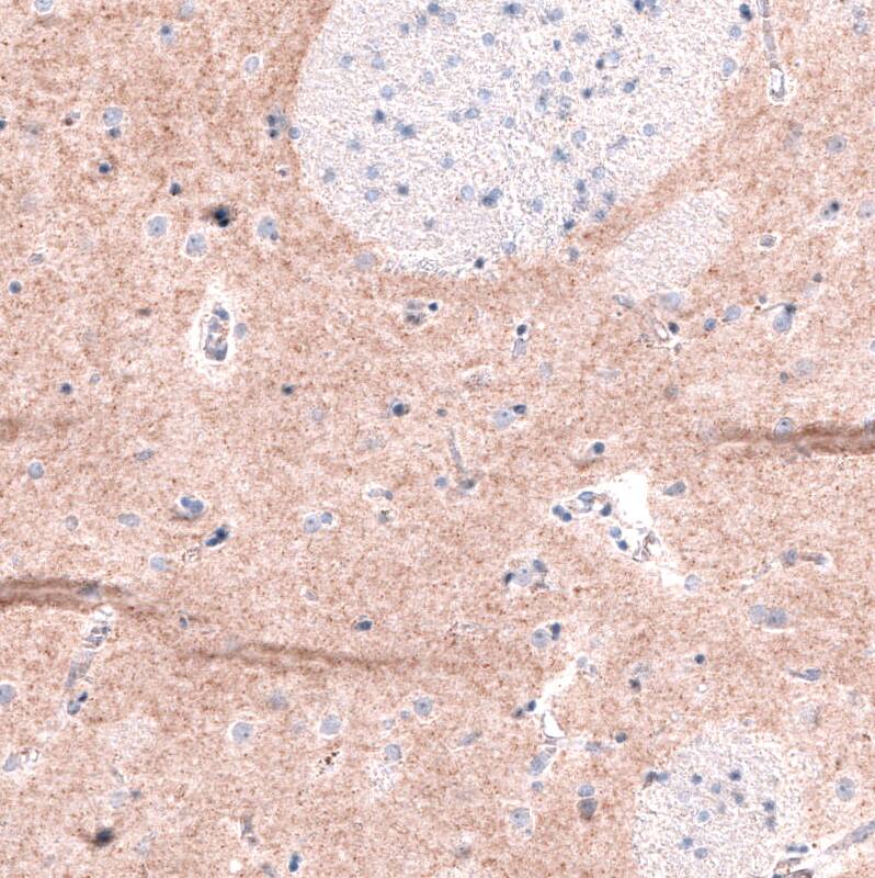 Staining of human caudate nucleus shows moderate positivity in neuronal processes.