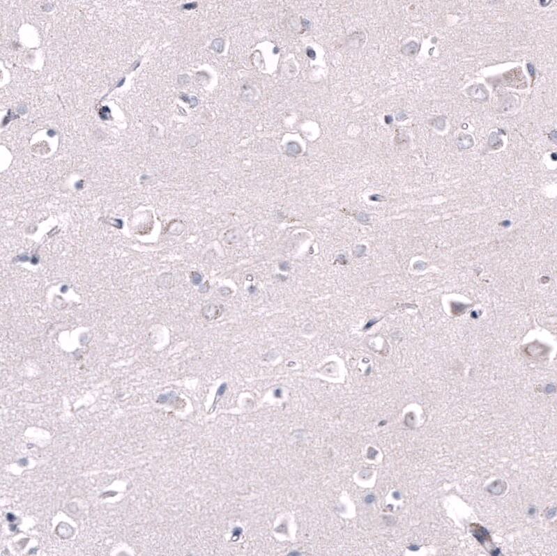 Staining of human cerebral cortex shows no positivity in neuropil as expected.