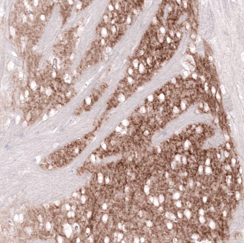 Staining of mouse caudate nucleus shows moderate positivity in neuronal processes.