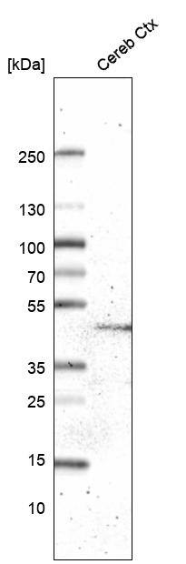 Analysis in human cerebral cortex tissue.