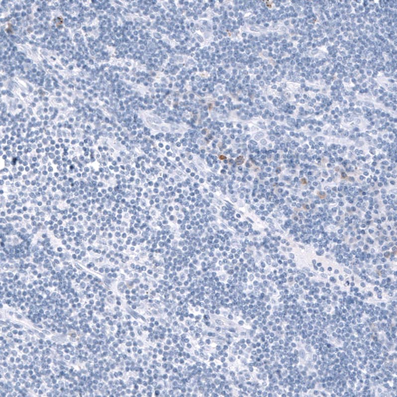 Staining of human lymph node shows very weak nuclear positivity in non-germinal center cells.