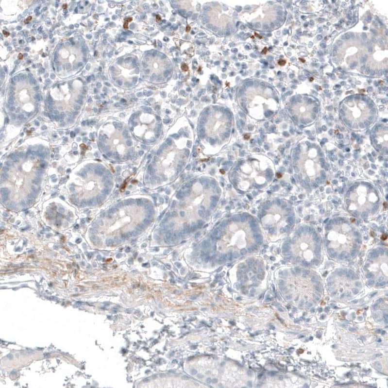 Staining of human duodenum shows moderate cytoplasmic positivity in lymphoid cells.