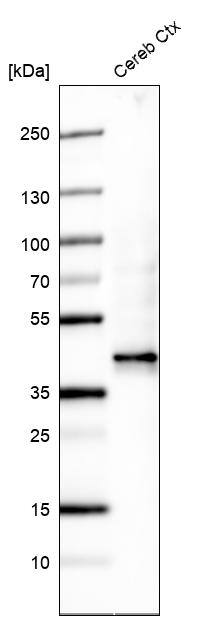 Analysis in human cerebral cortex tissue.