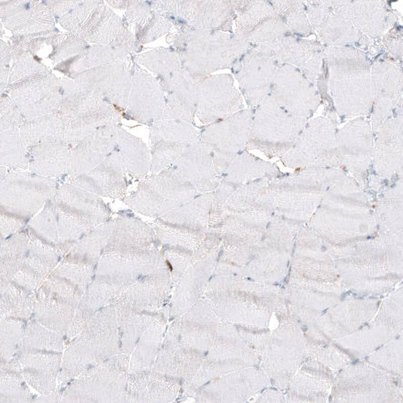 Staining of human skeletal muscle shows no positivity in myocytes as expected.