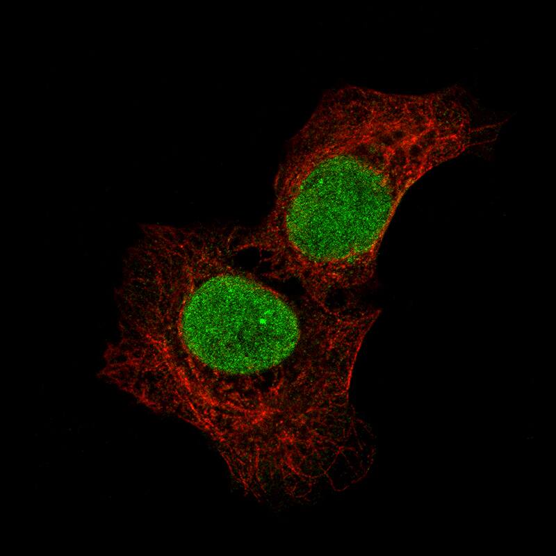 Staining of NTERA-2 cells, showing specific staining in the nucleoplasm and cytosol in green. Microtubule- and nuclear probes are visualized in red and blue, respectively (where available).
