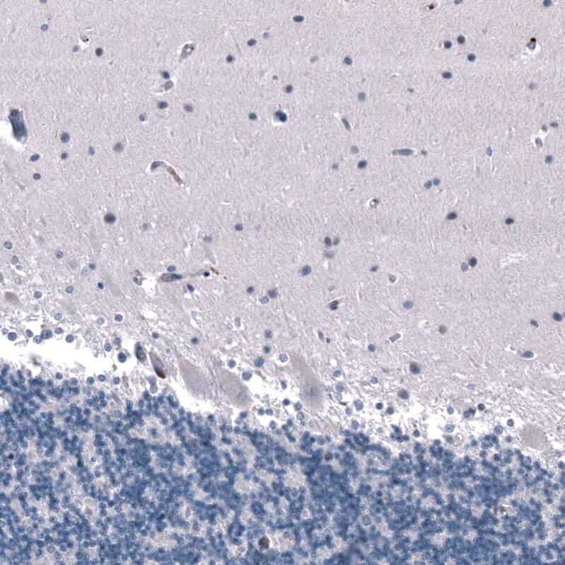Staining of human cerebellum shows no positivity in Purkinje cells as expected.
