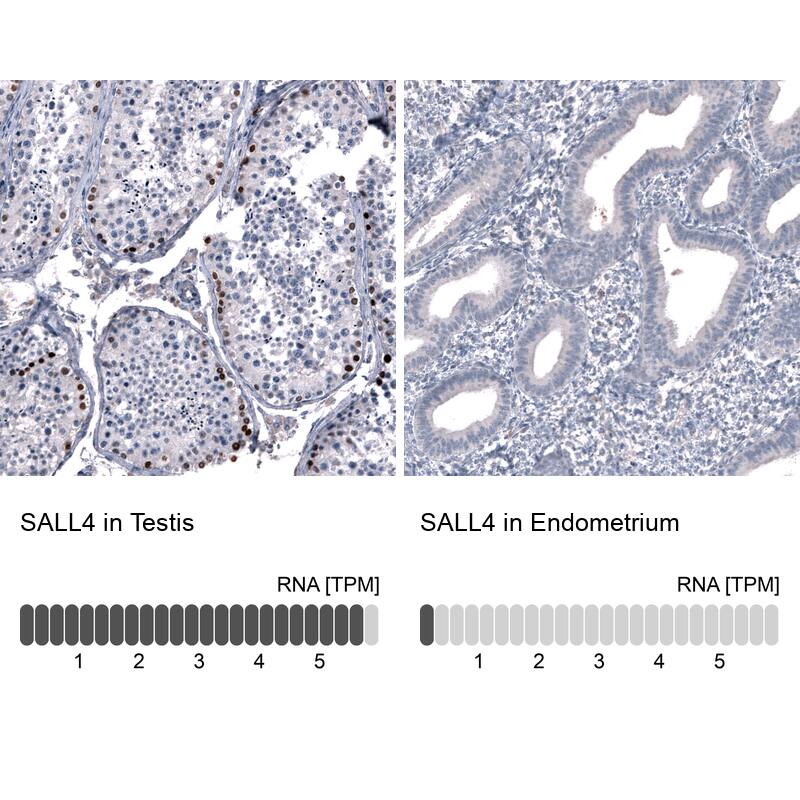 Analysis in human testis and endometrium tissues using NBP3-44347 antibody. Corresponding SALL4 RNA-seq data are presented for the same tissues.