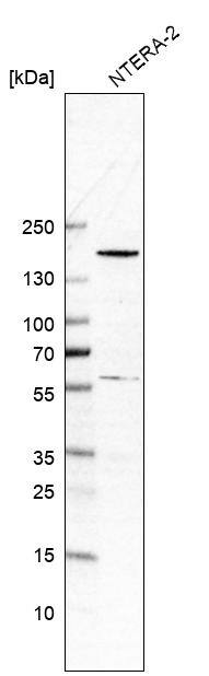 Analysis in human cell line NTERA-2.