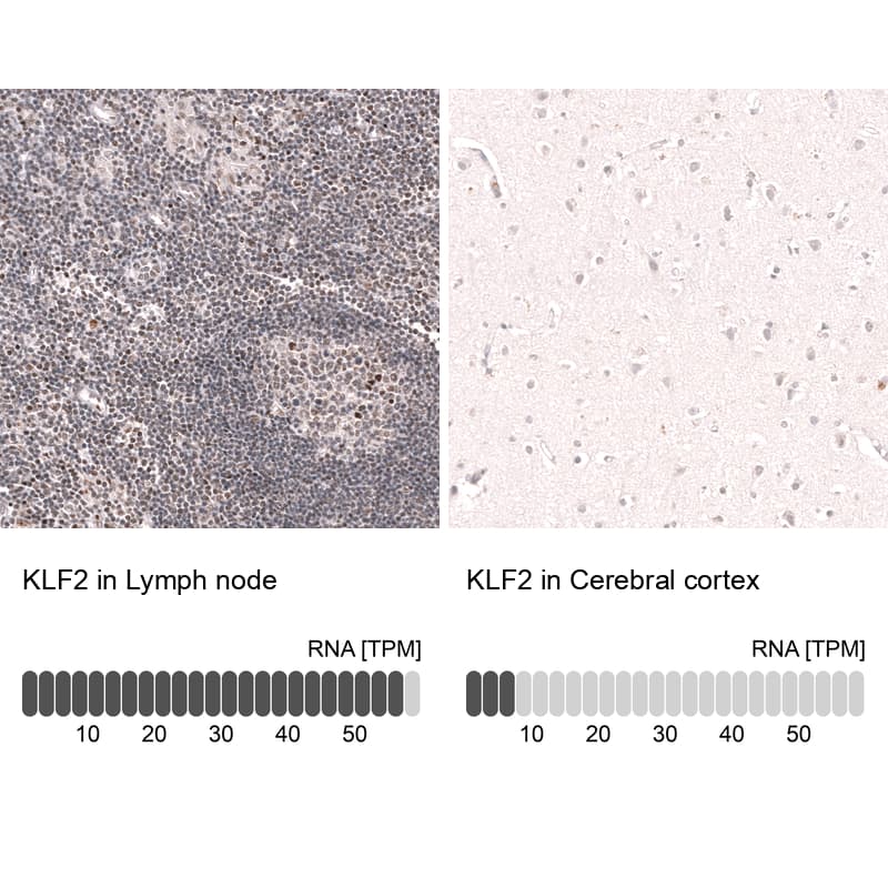 Analysis in human lymph node and cerebral cortex tissues using NBP3-44350 antibody. Corresponding KLF2 RNA-seq data are presented for the same tissues.