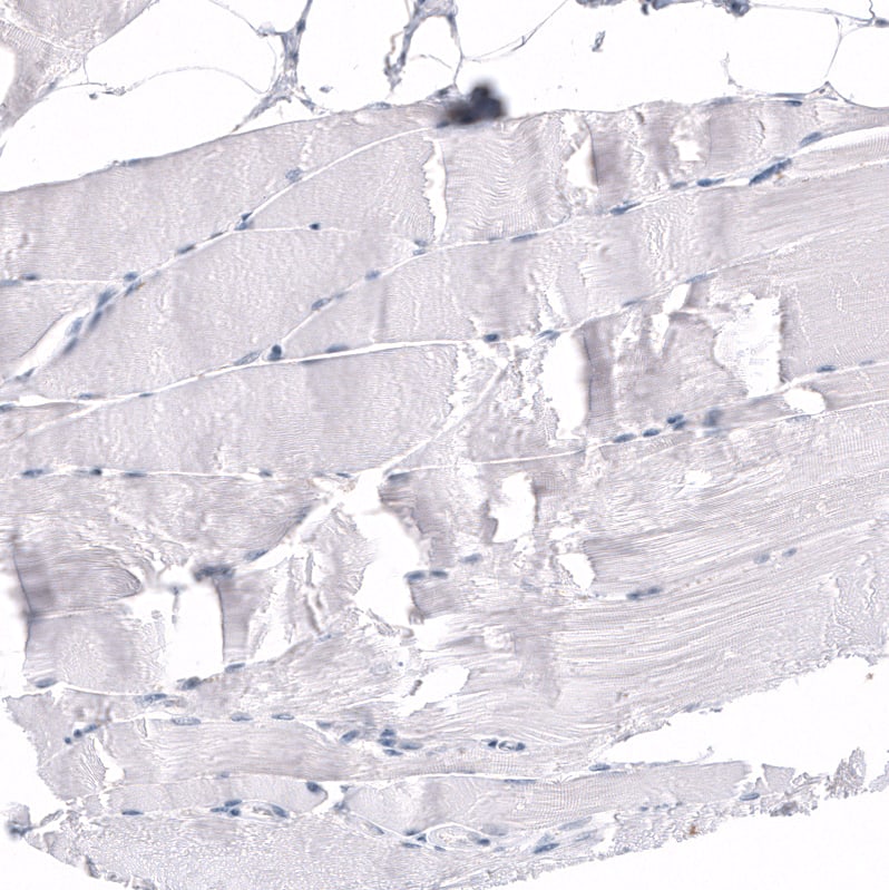 Staining of human skeletal muscle shows no positivity in myocytes as expected.