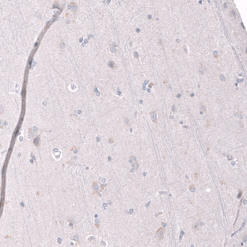 Staining of human cerebral cortex shows no positivity in neurons as expected.
