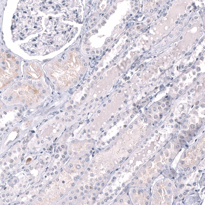 Staining of human kidney shows no positivity in cells in tubules as expected.