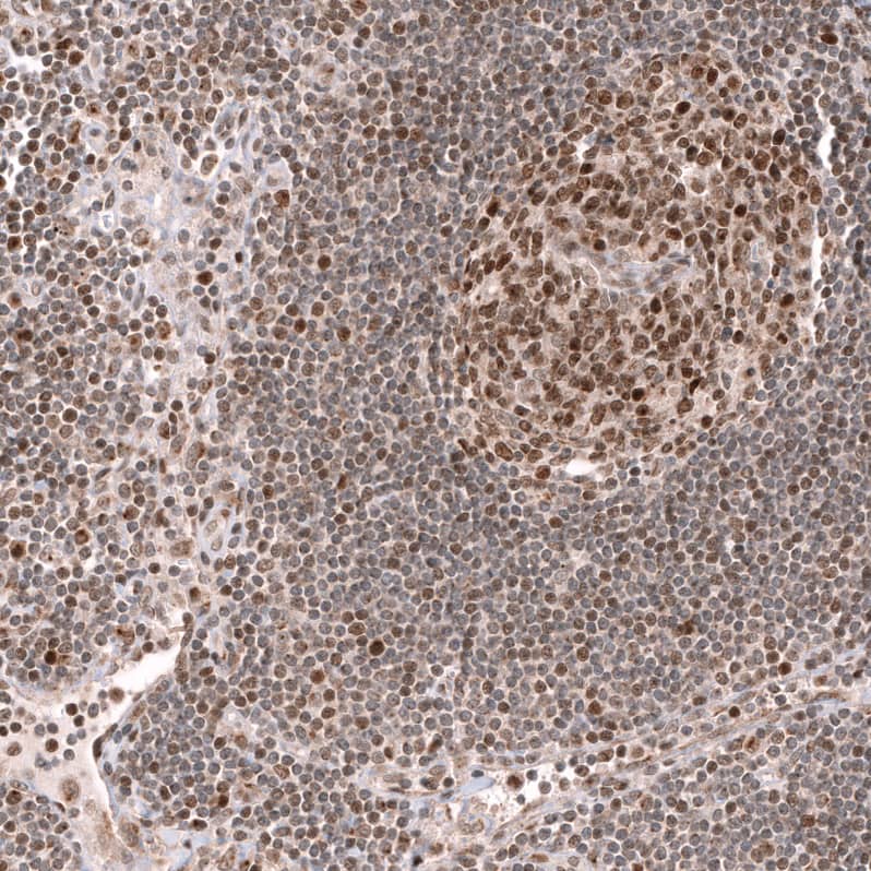 Staining of human lymph node shows moderate to strong nuclear positivity in lymphoid cells.