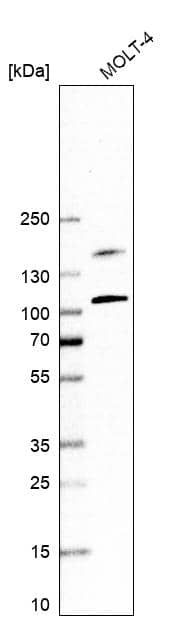 Analysis in human cell line MOLT-4.
