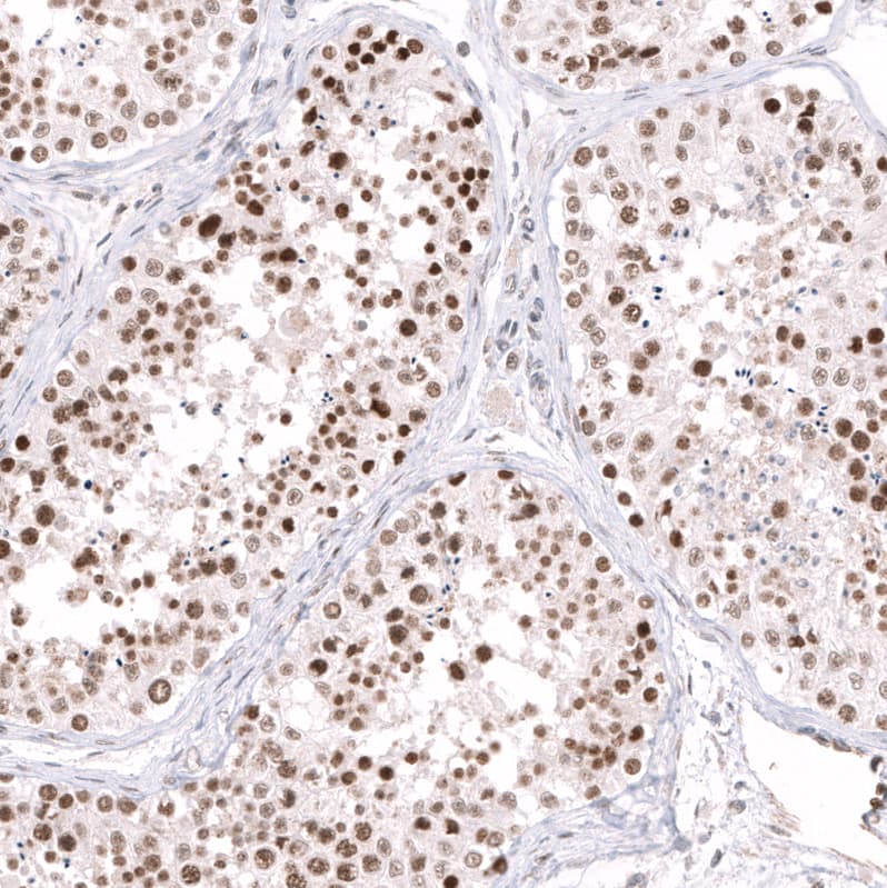 Staining of human testis shows moderate to strong nuclear positivity in cells in seminiferous ducts.