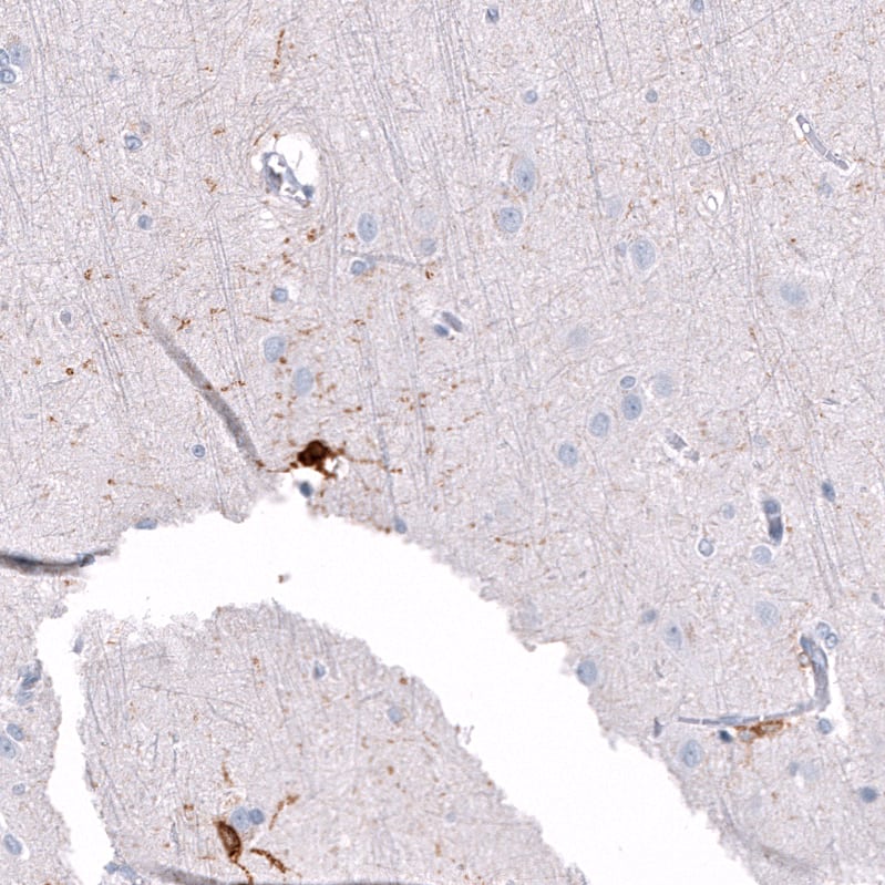 Staining of human cerebral cortex shows strong cytoplasmic positivity in glial cells.