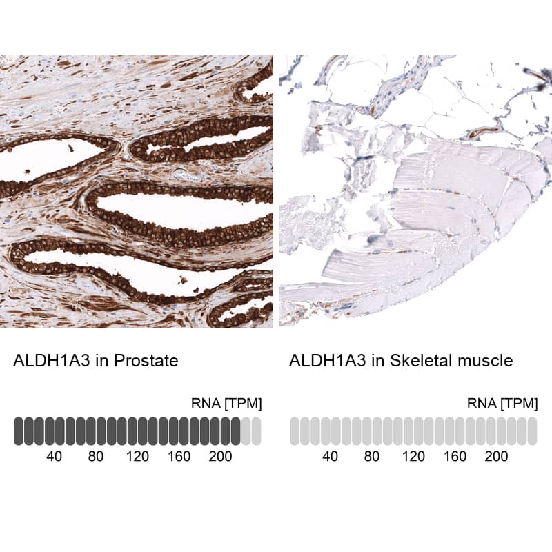 Analysis in human prostate and skeletal muscle tissues using NBP3-44356 antibody. Corresponding ALDH1A3 RNA-seq data are presented for the same tissues.