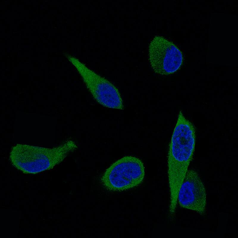 Staining of PC-3 cells using the Anti-ALDH1A3 monoclonal antibody, showing specific staining in cytosol in green. Nuclear probe is visualized in blue.