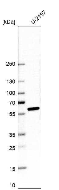 Analysis in human cell line U-2197.