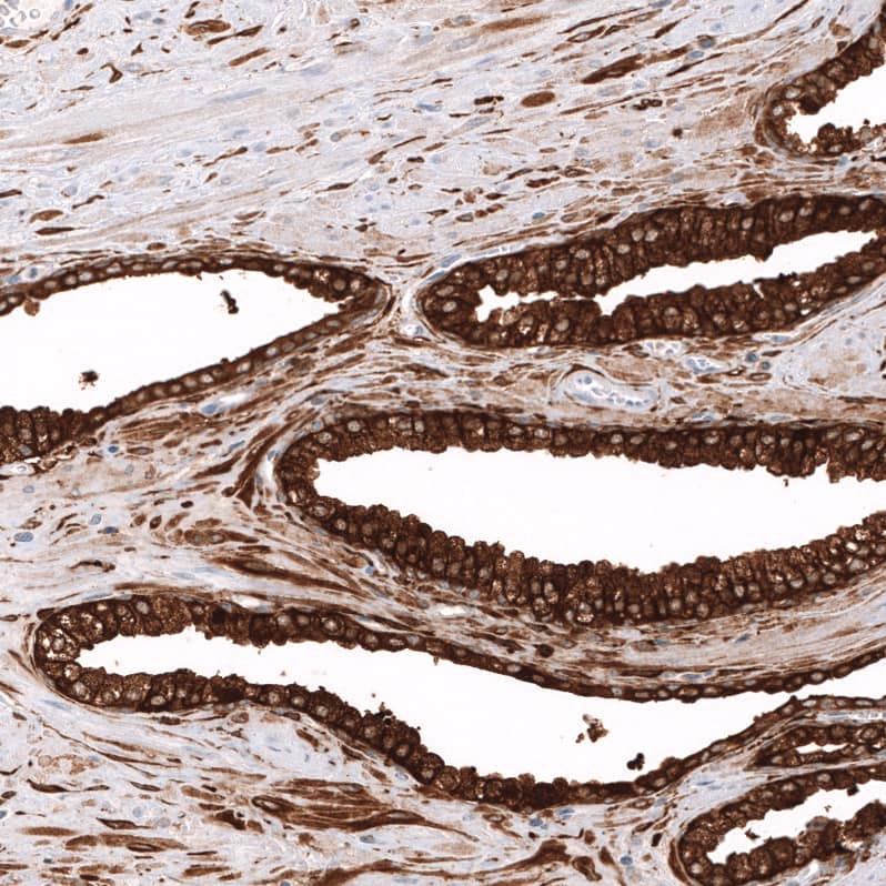 Staining of human prostate shows strong cytoplasmic positivity in glandular cells.
