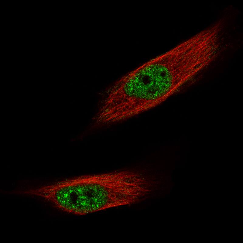 Staining of U-251 MG cells, showing specific staining in nuclear speckles and nucleoplasm in green. Microtubule- and nuclear probes are visualized in red and blue, respectively (where available).