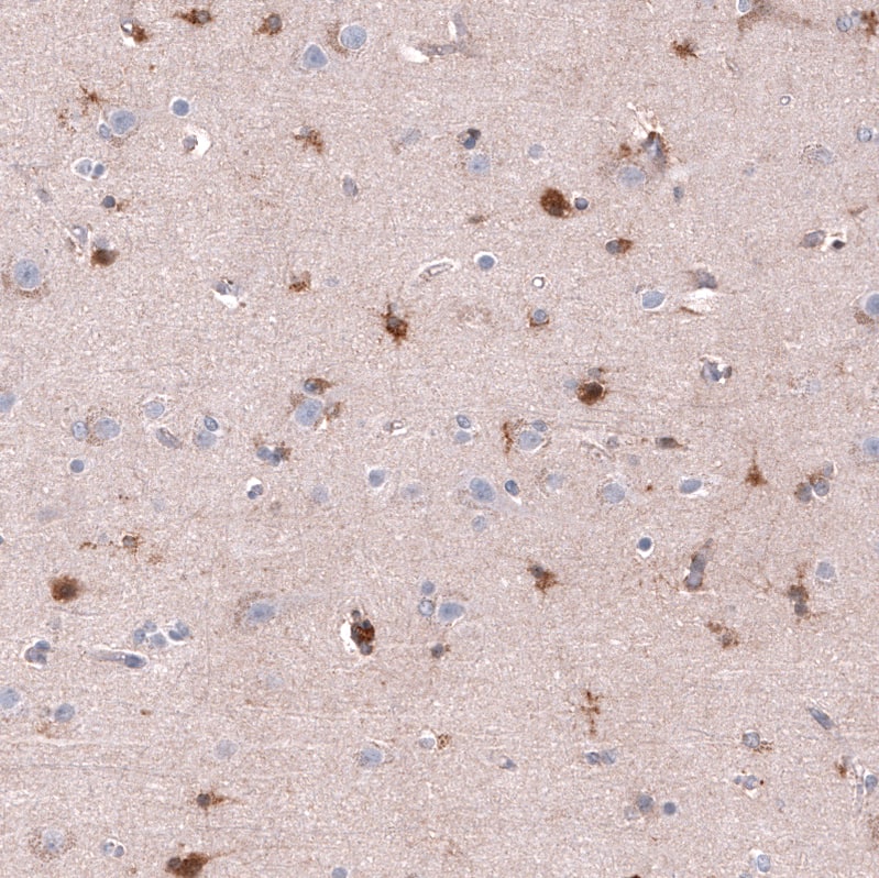 Staining of human cerebral cortex shows moderate to strong cytoplasmic positivity in glial cells.