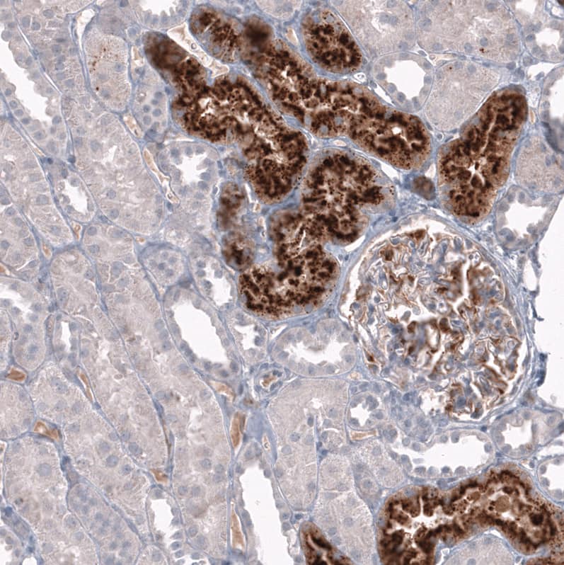 Staining of human kidney shows strong granular cytoplasmic positivity in cells in tubules.