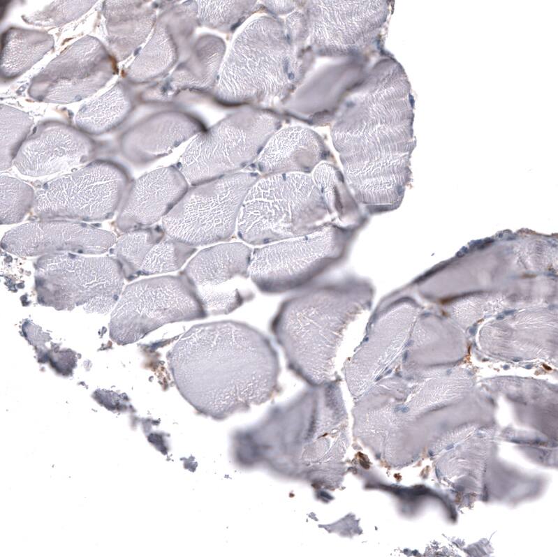 Staining of human skeletal muscle shows no positivity in myocytes as expected.