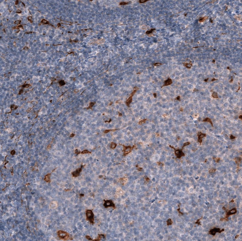 Staining of human tonsil shows strong cytoplasmic positivity in a subset of lymphoid cells.