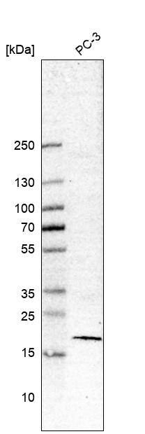 Analysis in human cell line PC-3.