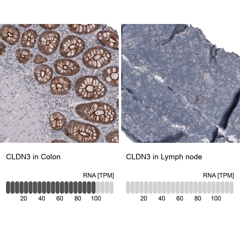 Analysis in human colon and lymph node tissues using NBP3-44368 antibody. Corresponding Claudin-3 RNA-seq data are presented for the same tissues.