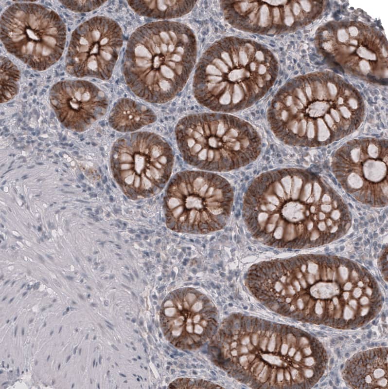 Staining of human colon shows moderate to strong membranous positivity in glandular cells.