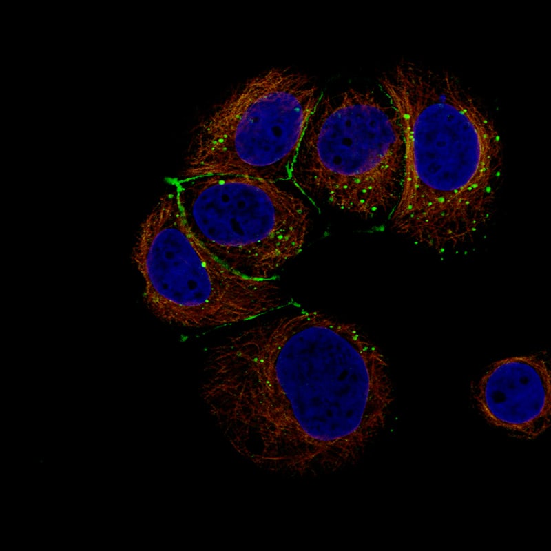 Staining of MCF-7 cells using the Anti-Claudin-3 monoclonal antibody) .
