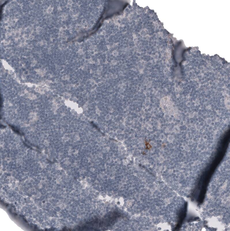 Staining of human lymph node shows no positivity in non-germinal center cells as expected.