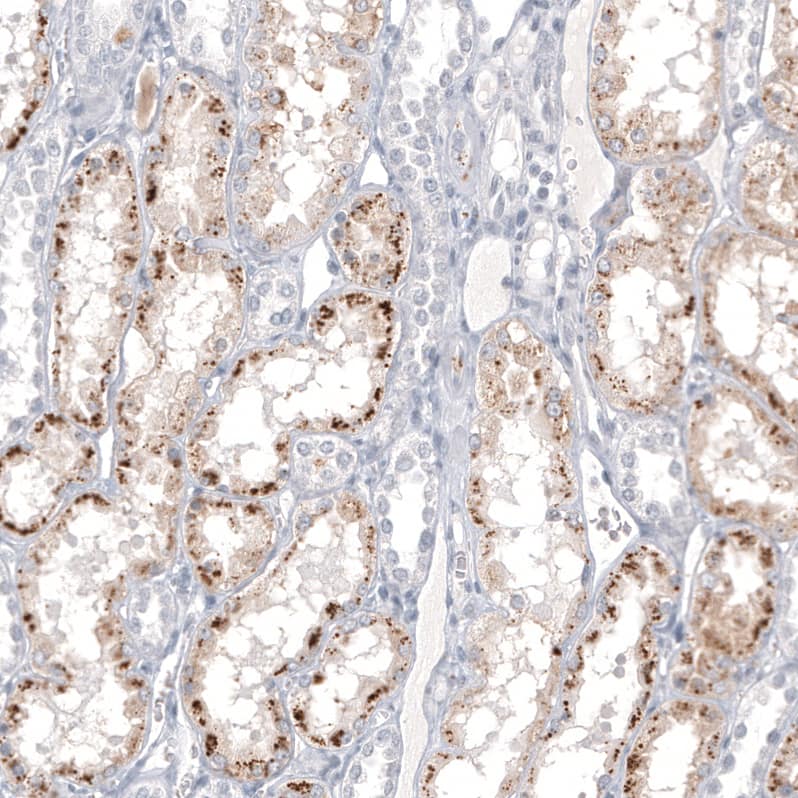 <b>Orthogonal Strategies Validation. </b>Staining of human kidney shows moderate to strong cytoplasmic positivity in cells in tubules.