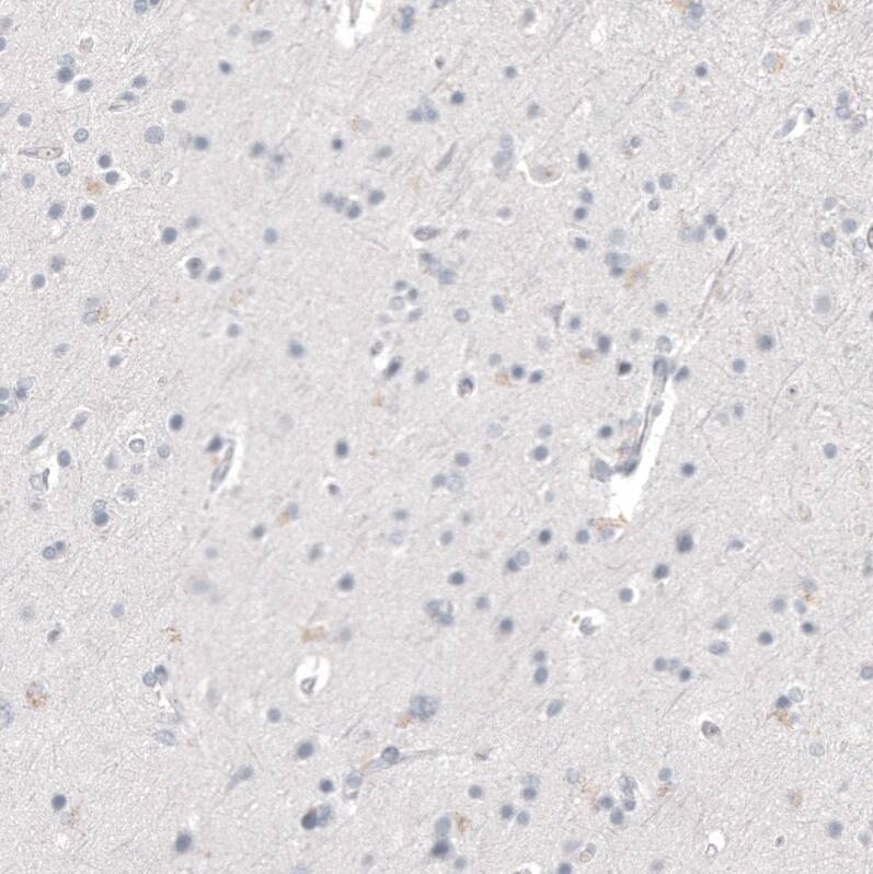 Staining of human cerebral cortex shows no positivity in neurons as expected.