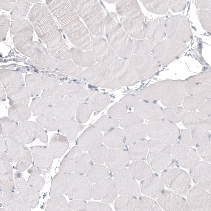Staining of human skeletal muscle shows no positivity in myocytes as expected.