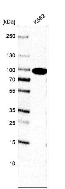 Analysis in human cell line K562.