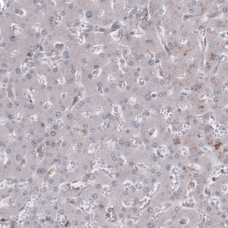 Staining of human liver shows no positivity in hepatocytes.