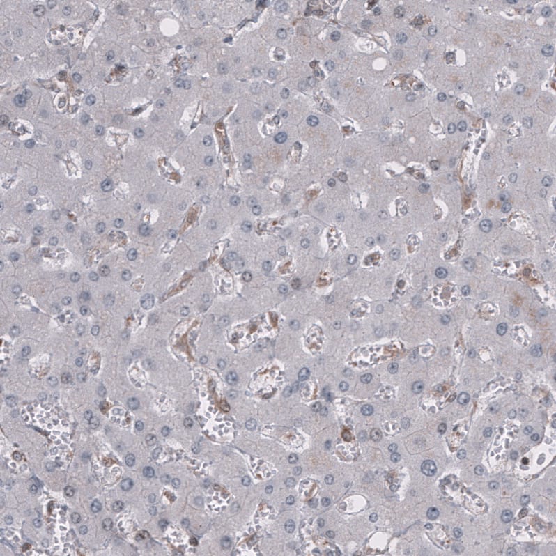 Staining of human liver shows no positivity in hepatocytes.