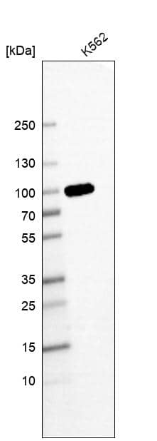 Analysis in human cell line K562.