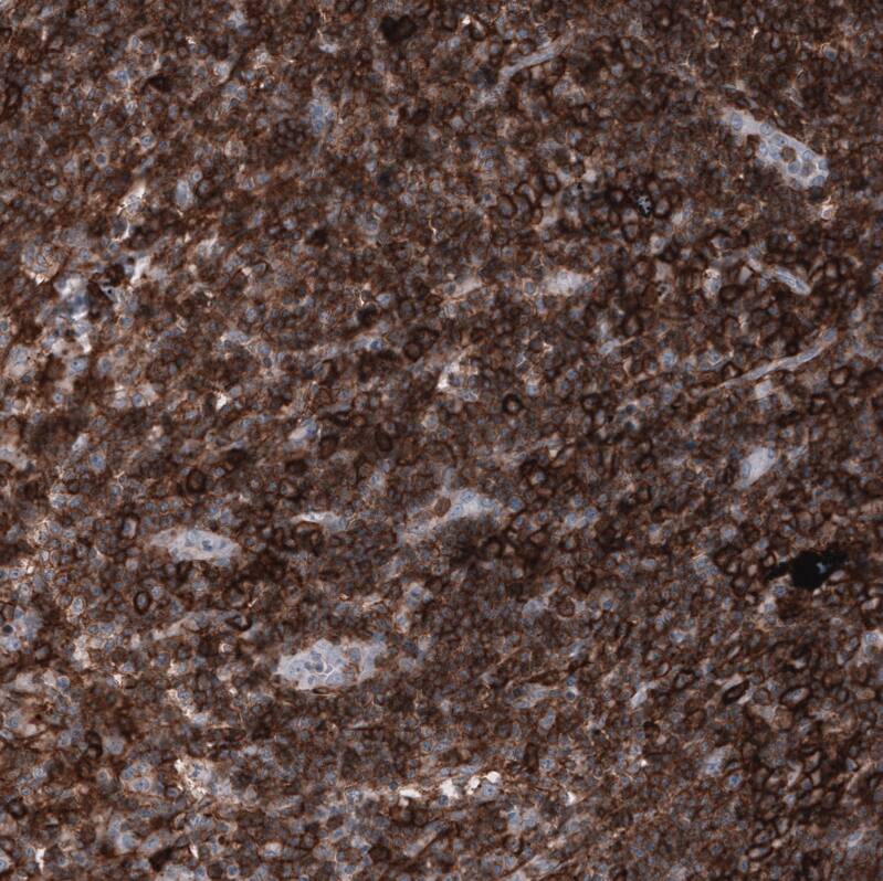Staining of human lymph node shows strong membranous positivity in lymphoid cells.