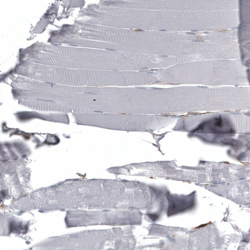 Staining of human skeletal muscle shows no positivity in myocytes as expected.