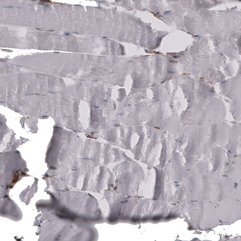 Staining of human skeletal muscle shows no positivity in myocytes as expected.