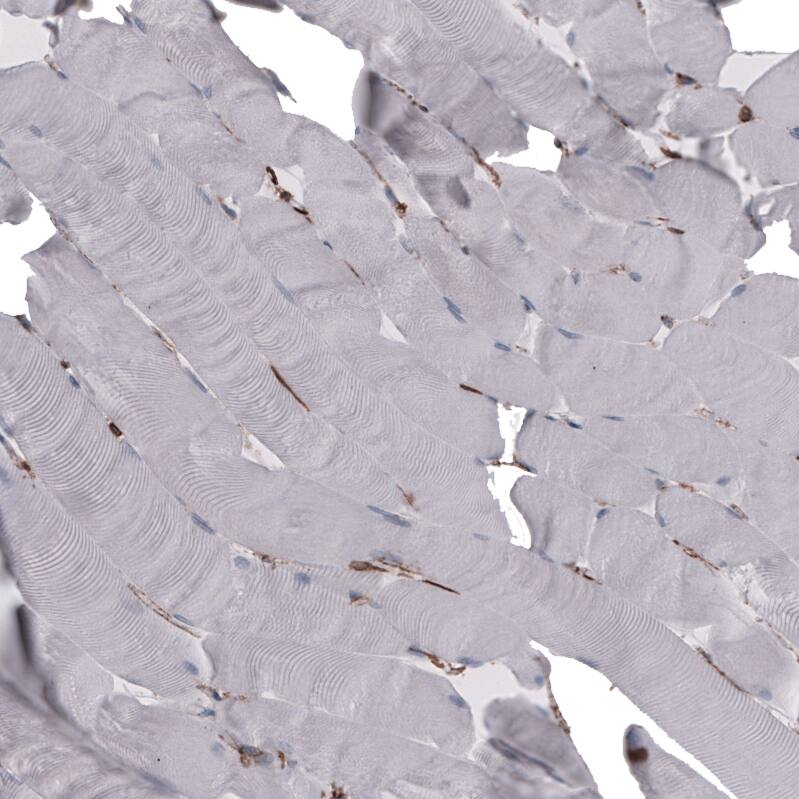 Staining of human skeletal muscle shows no positivity in myocytes as expected.