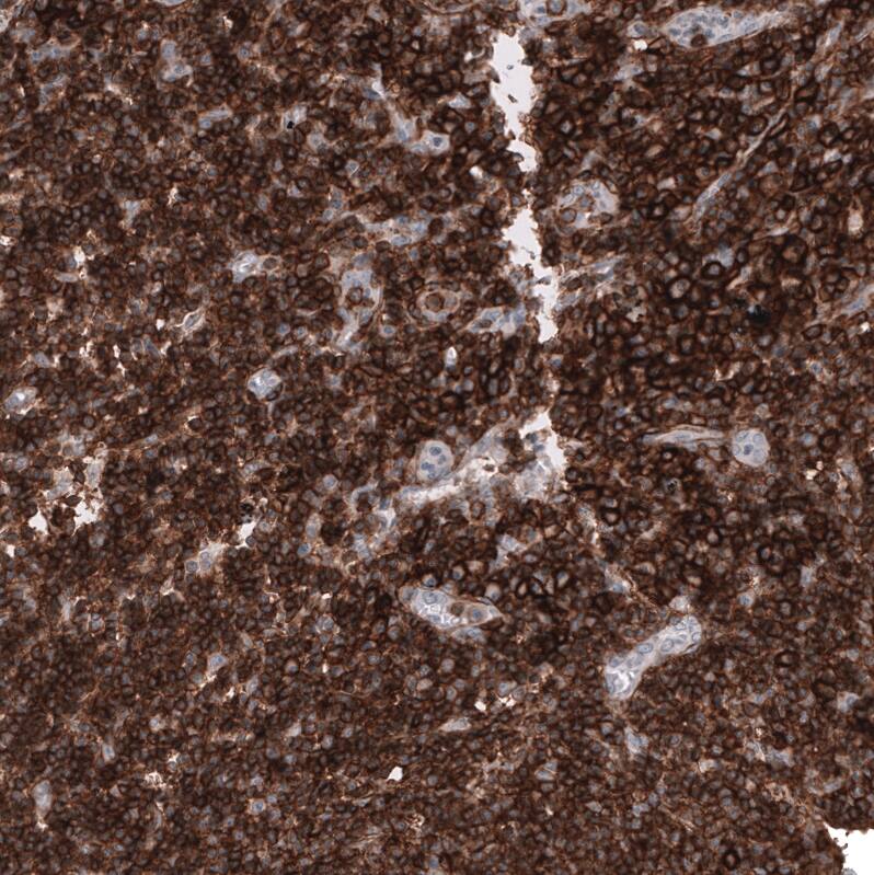 Staining of human lymph node shows strong membranous positivity in lymphoid cells.